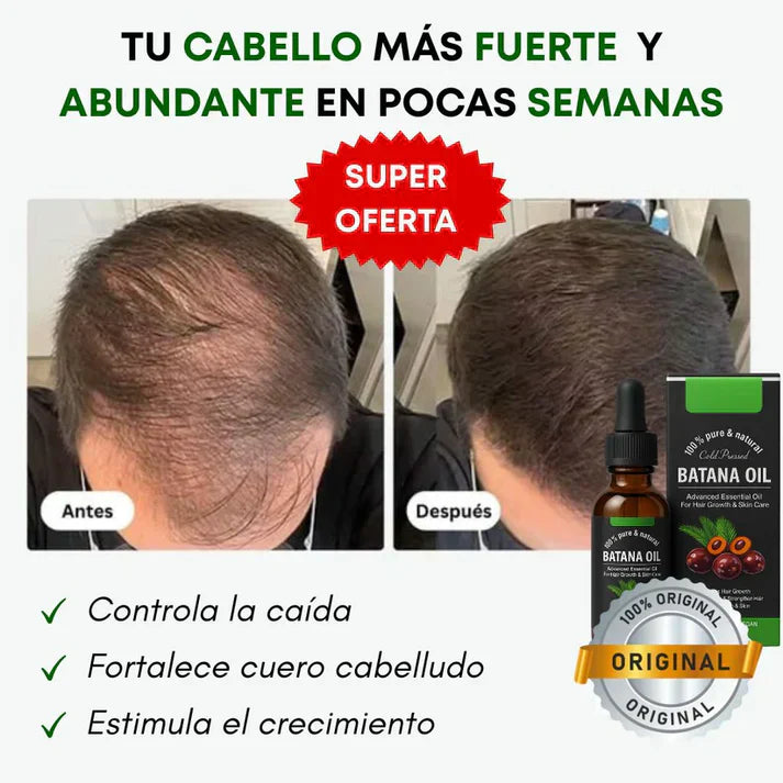 Aceite de Batana®:Da brillo, hidrata y fortalece | Envío Gratis 🎁